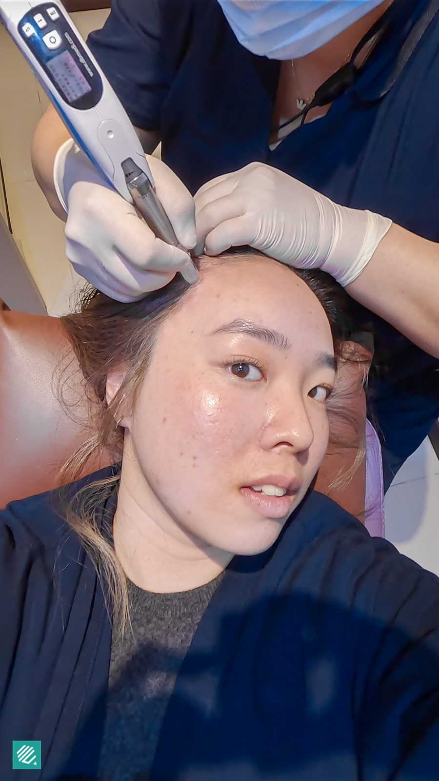 Steam cell hair treatment in Korea